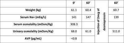 Central Diabetes Insipidus Following Immunization With BNT162b2 mRNA COVID-19 Vaccine: A Case Report